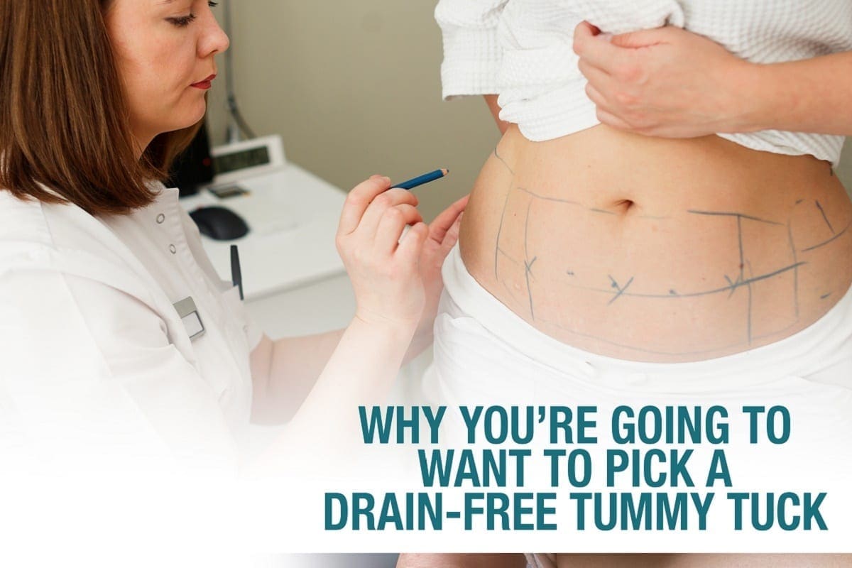 Why You're Going to Want to Pick a Drain-Free Tummy Tuck [Infographic]