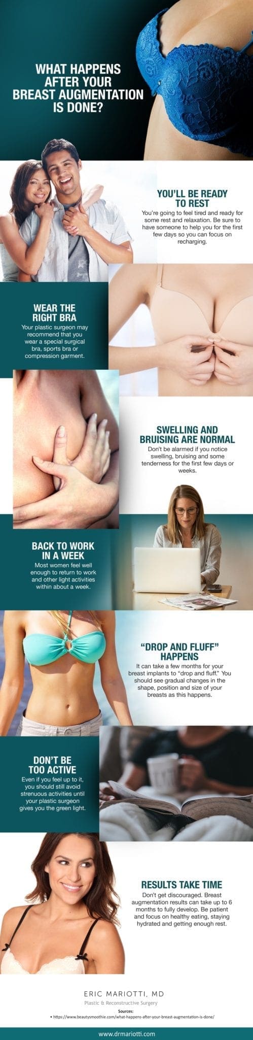 What Happens After Your Breast Augmentation is Done? [Infographic] img 1