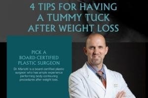 4 Tips for Having A Tummy Tuck After Weight Loss [Infographic]