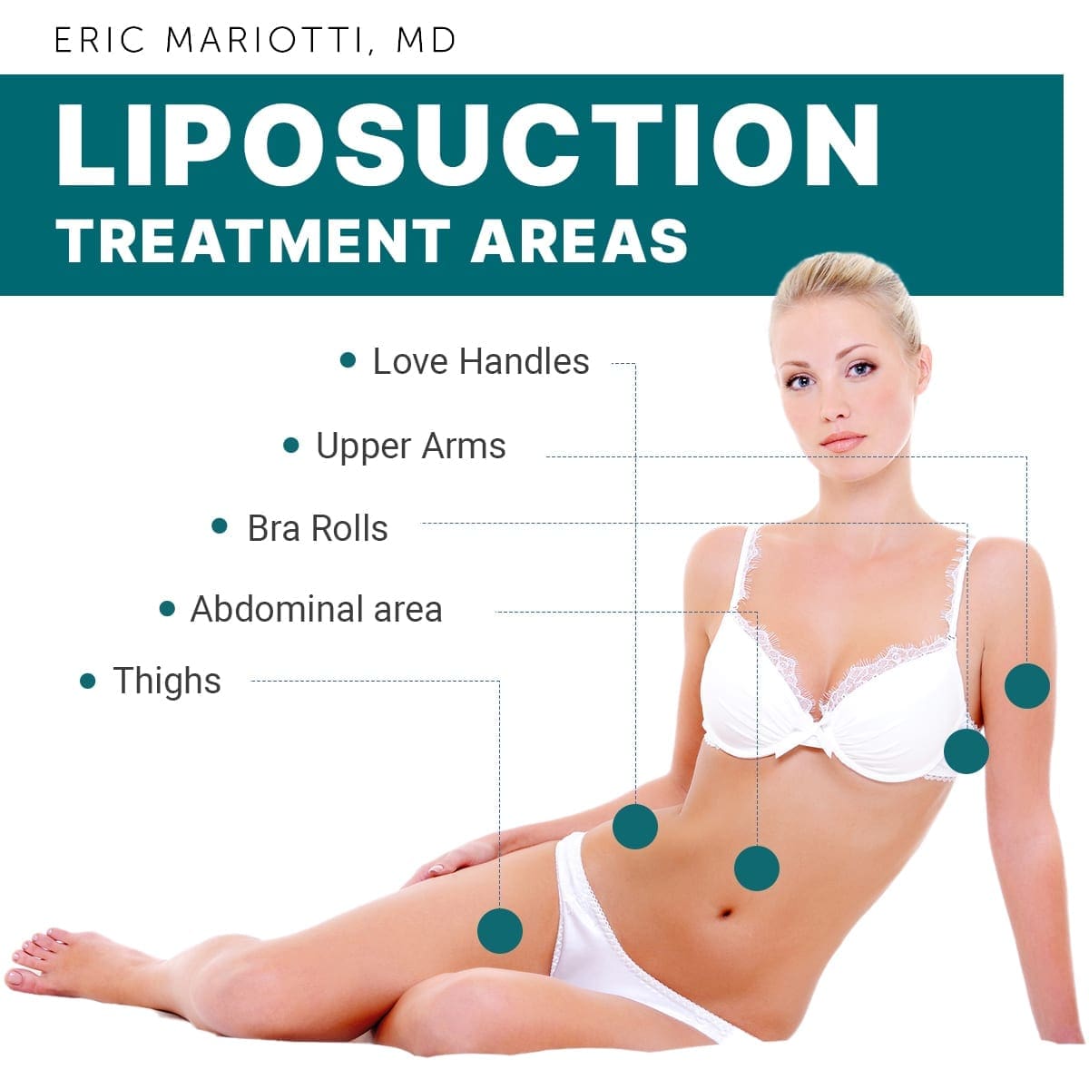 Liposuction Treatment Areas [Infographic] img 1